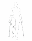 FF-PWD-Woman_ProstheticLegCanes